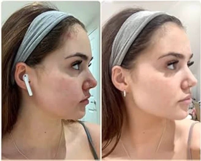 Electric Face Massager